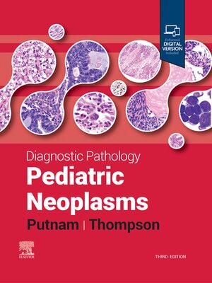 cover image of Pediatric Neoplasms